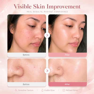 Collagen Niacinamide Jelly Cream